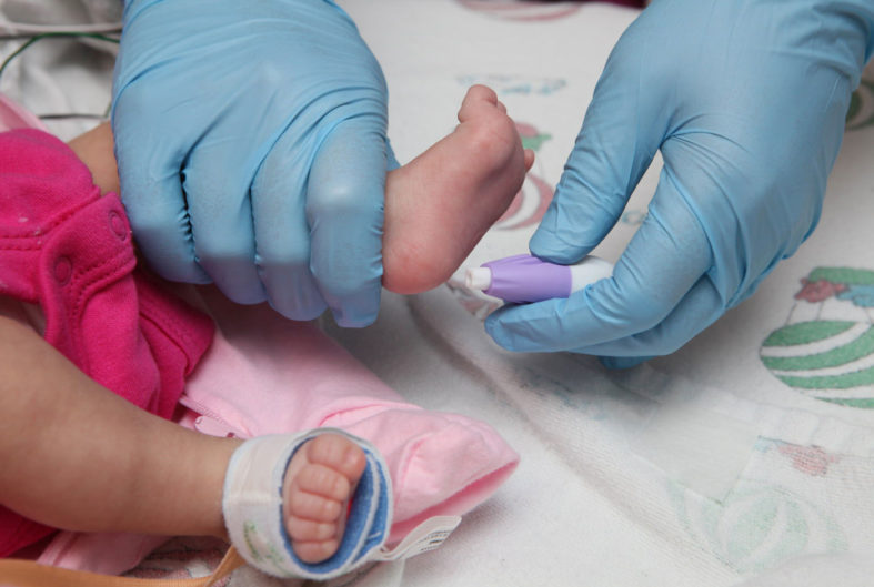 Screening neonatale per la fenilchetonuria (PKU)
