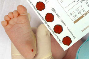 Screening neonatale: l’appello delle associazioni per l’approvazione dell’emendamento alla legge 167/2016