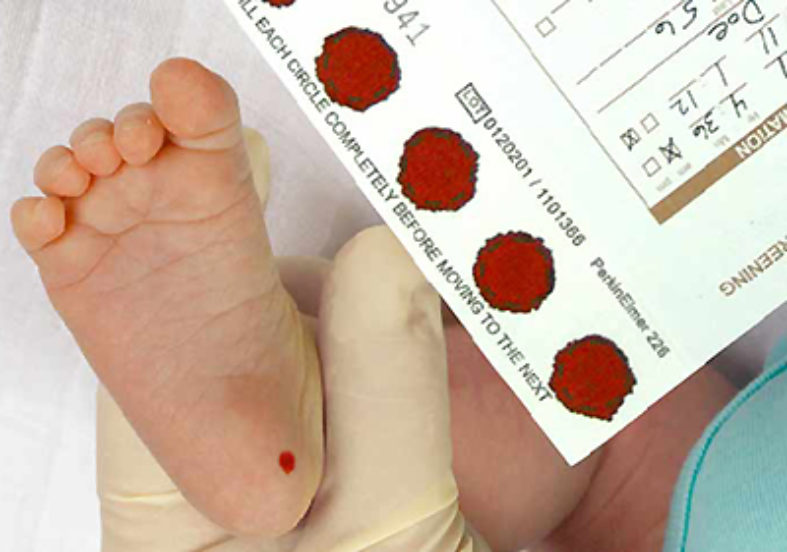 Screening neonatale: l’appello delle associazioni per l’approvazione dell’emendamento alla legge 167/2016