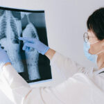 radiografia polmoni