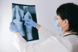 Fibrosi cistica: con lo screening neonatale i costi sanitari diretti sono 2,62 volte inferiori rispetto alla diagnosi clinica